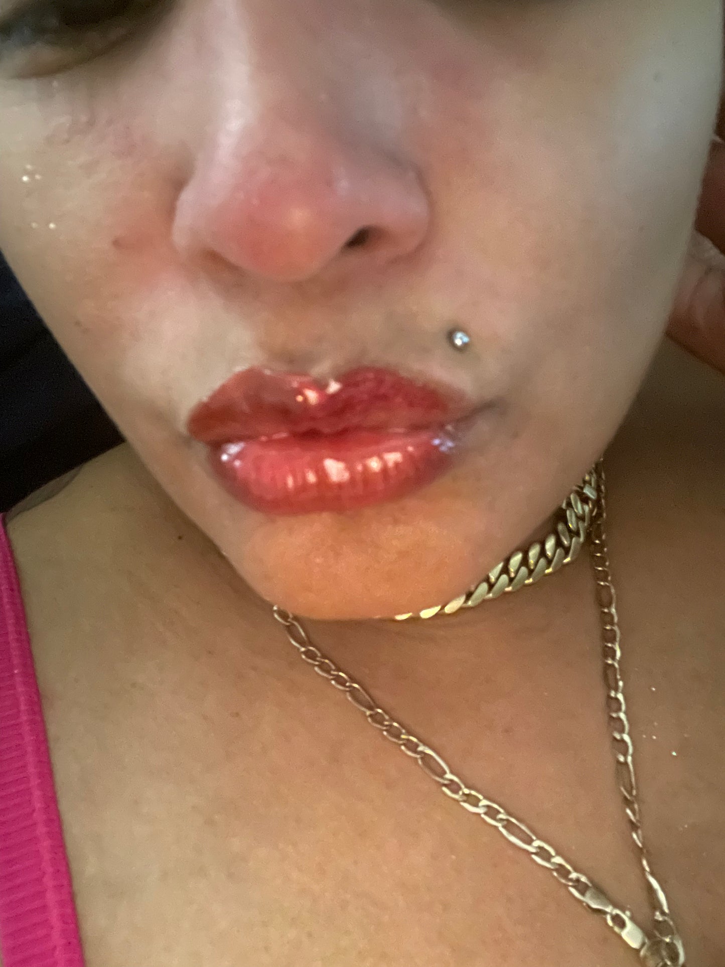 "Zorra"